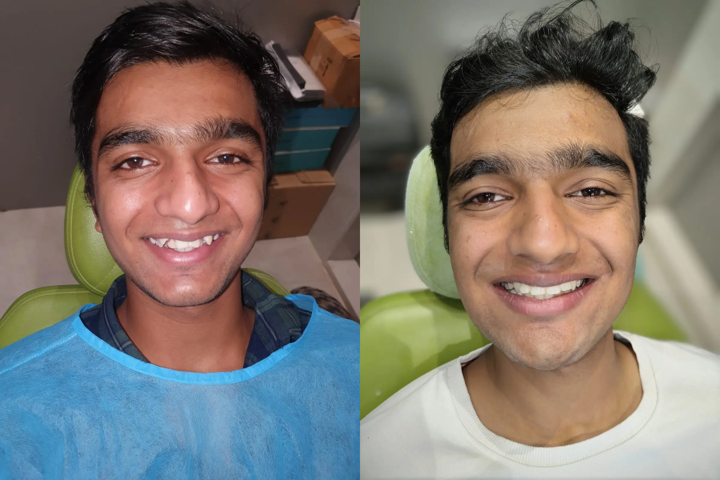 Dental Impant 6